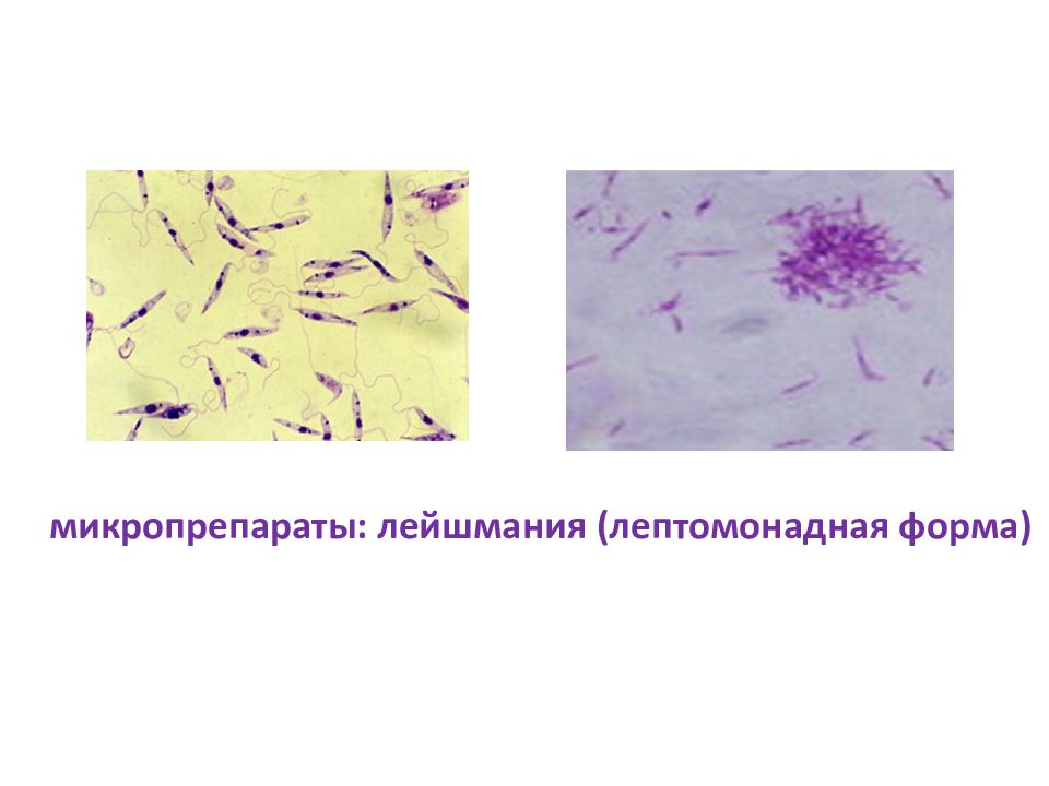 Описание микропрепарата. Лейшмания лептомонадная. Лептомонадная форма лейшмании возбудитель. Лейшмания микропрепарат. Leishmania Tropica лептомонадная форма возбудитель.