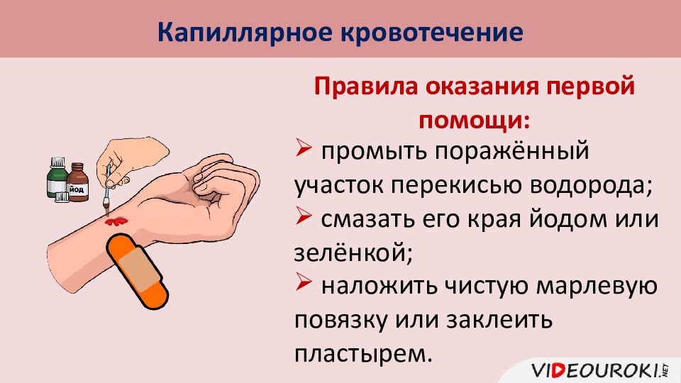 Кровотечение обж презентация