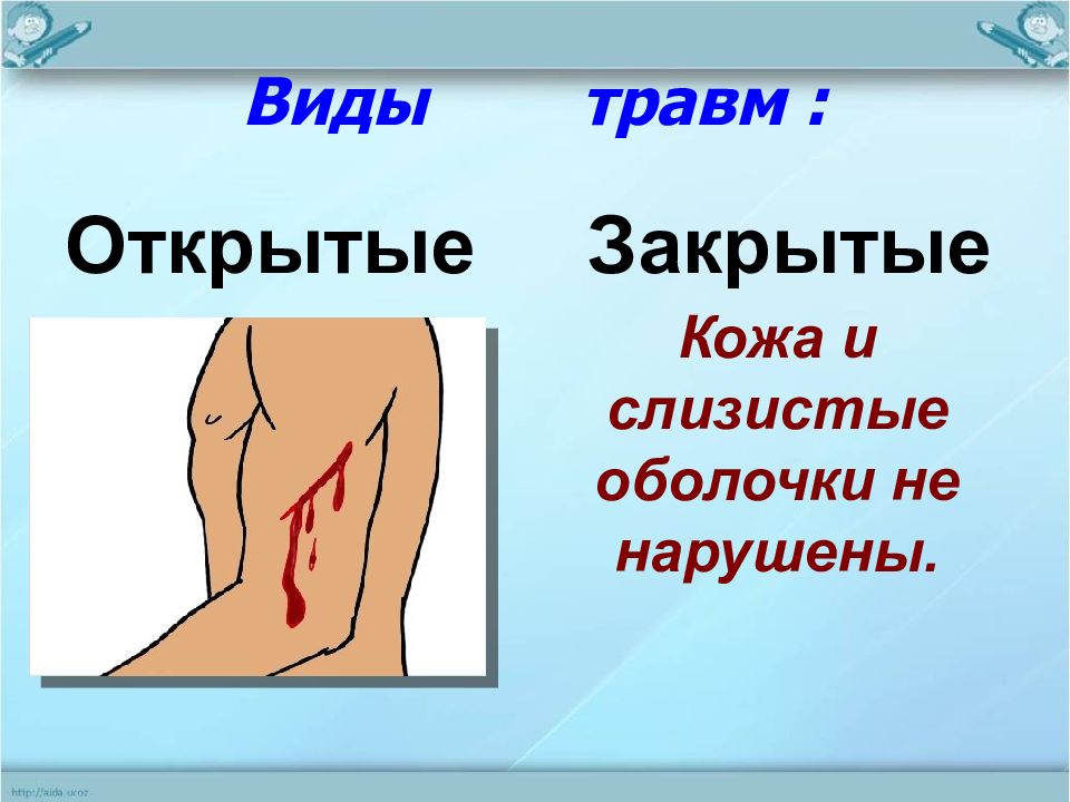 Виды травм рисунок. Закрытые и открытые виды травм. Виды повреждений.