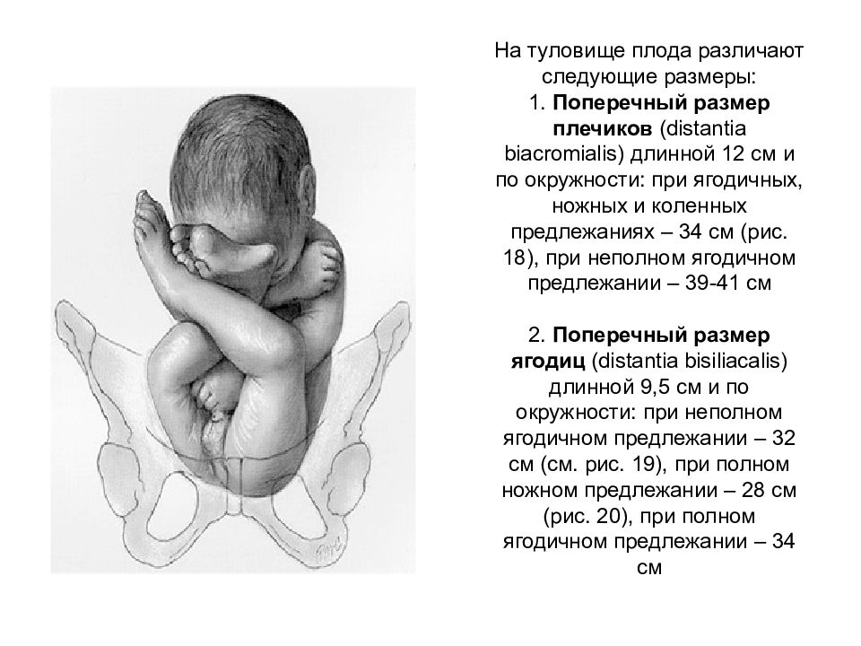 Головка плода как объект родов презентация