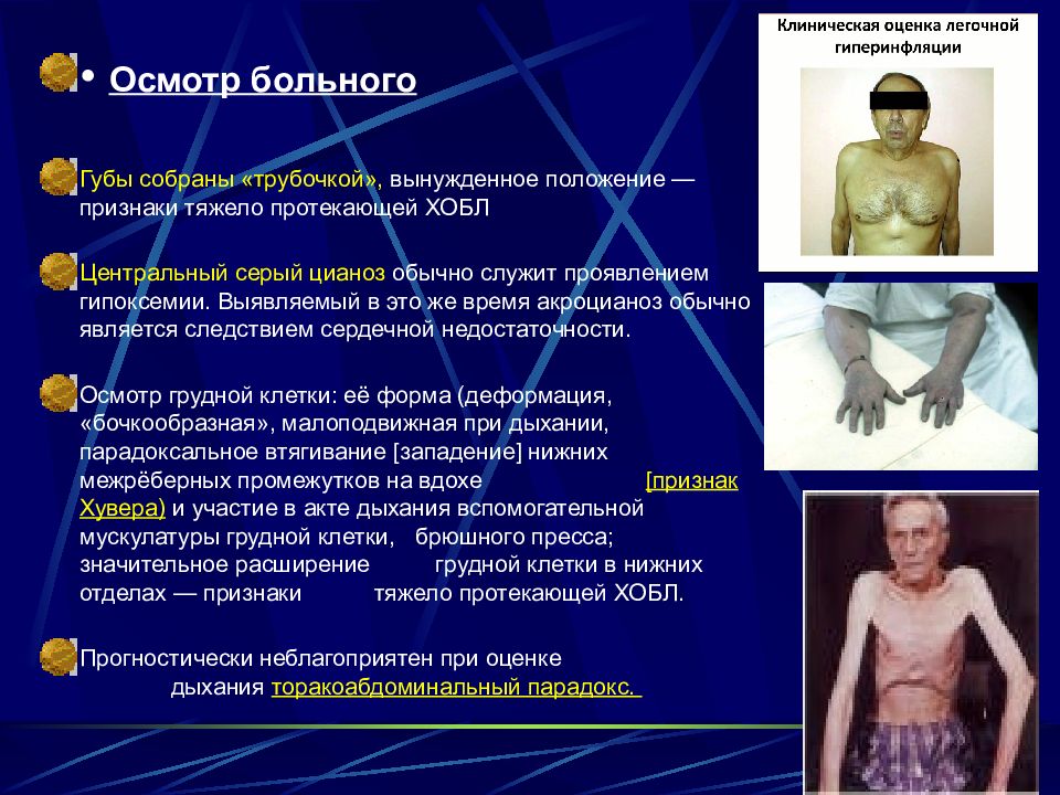 Сложно протекающая. Признаки ХОБЛ. ХОБЛ признаки симптомы.