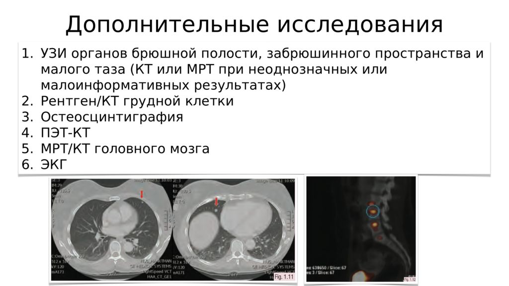 Пэт кт молочной железы