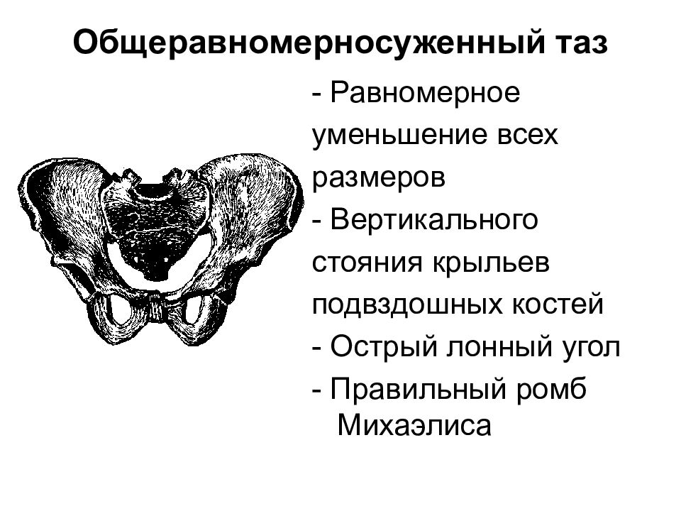 Анатомически и клинически узкий таз презентация