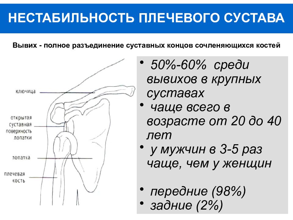 Вывих плеча мкб 10. Нестабильность плечевого суставв. Передняя нестабильность плечевого сустава. Нестабильность плечевого сустава симптомы. Нестабильность плечевого сустава операция.