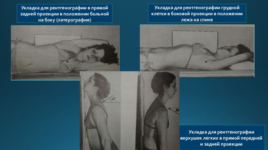 Рентгенография в прямой проекции. Рентгенография грудины укладка. Укладка при рентгенографии грудной клетки. Рентгенография грудины в боковой проекции укладка. Рентген грудной клетки в прямой проекции.