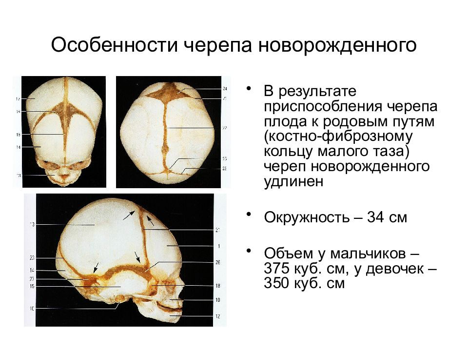 Роднички плода. Швы и роднички черепа анатомия. Роднички черепа анатомия. Особенности строения черепа у новорожденных. Роднички новорожденного анатомия черепа.