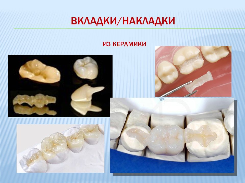 Стоматологическая керамика презентация