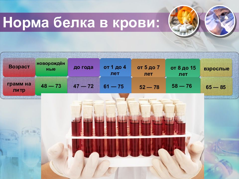 Изменение белка в крови. Общий белок. Белок в крови. Общий белок в крови. Общий белок в крови показатели.