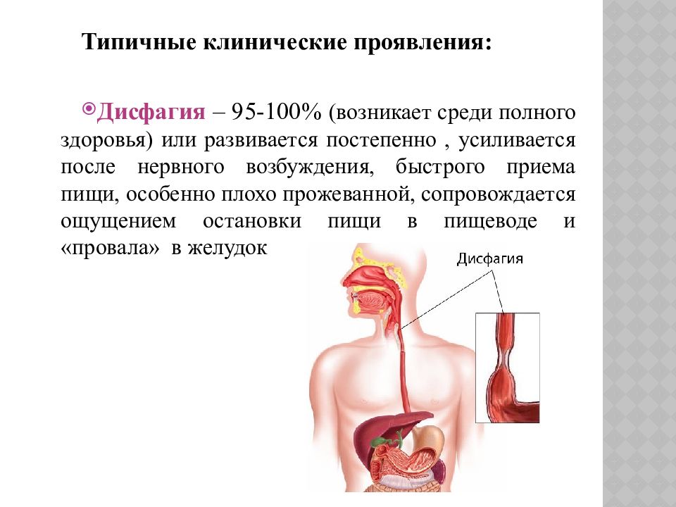 Недостаточность кардии что это