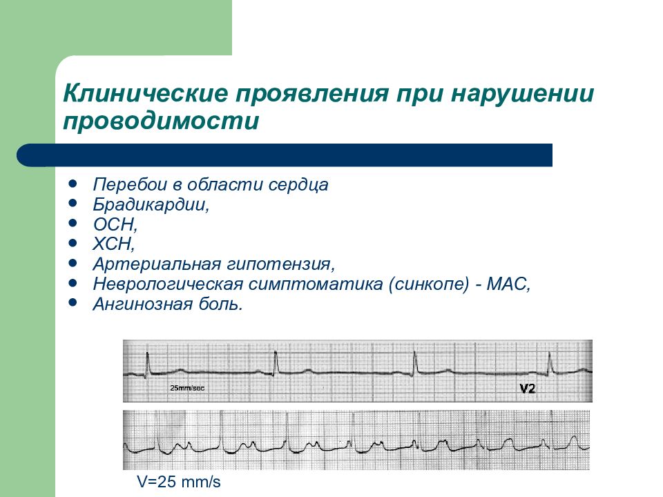 Нарушения проводимости презентация