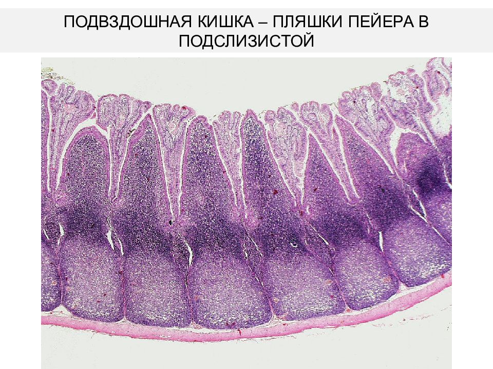 Эпителий кошки. Толстая кишка гистология препарат. Толстая кишка гистология. Подвздошная кишка гистология препарат. Пейеровы бляшки гистология препарат.