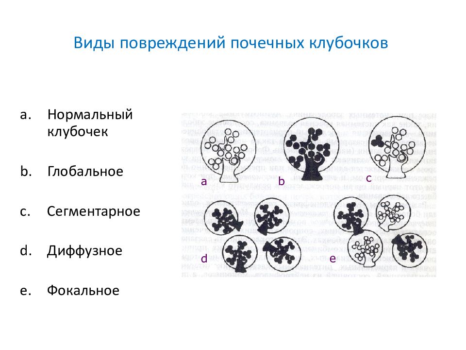 Рефлюкс нефропатия презентация