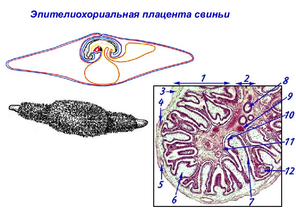 Пупочный канатик строение. Желточный период развития системы кровообращения. Анатомическая классификация плацент. Плацента свиней. Плацента свиней.
