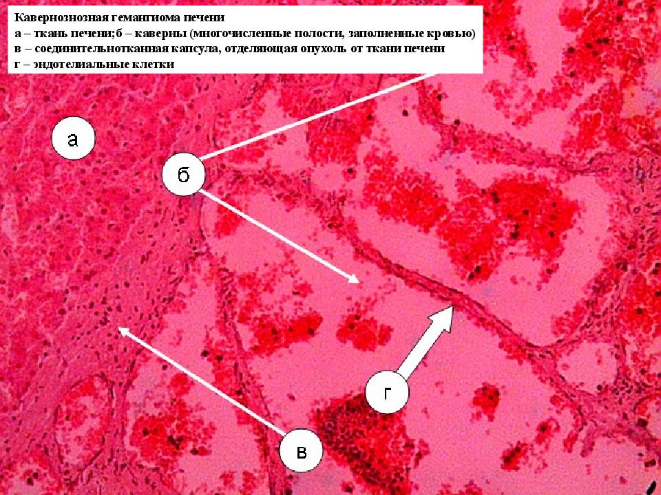 Ткани печени. Гепатоциты ткань печени. Соединительнотканная капсула печени микропрепарат.
