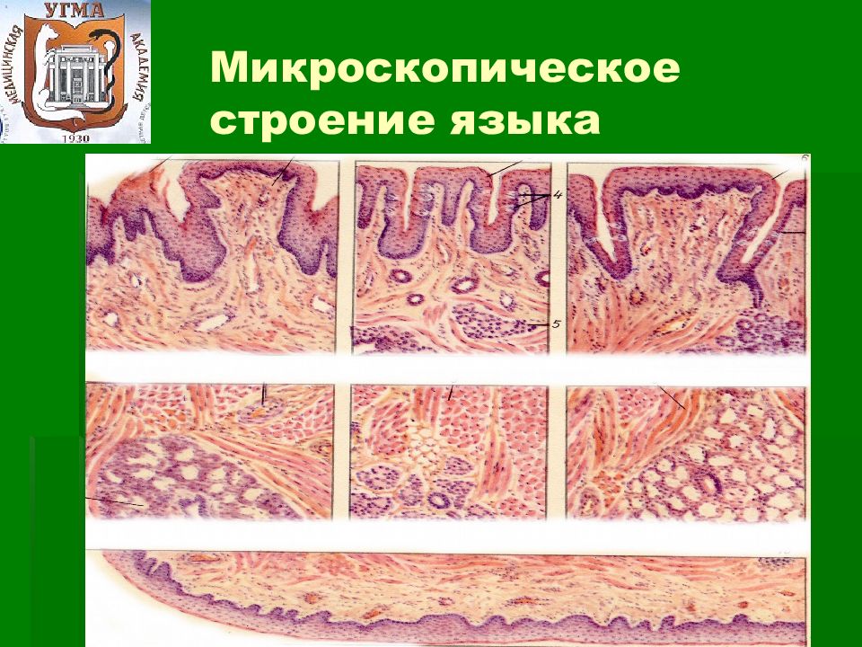 Язык гистология. Микроскопическое строение языка. Гистологическое строение языка. Нижняя поверхность языка гистология. Строение языка гистология.