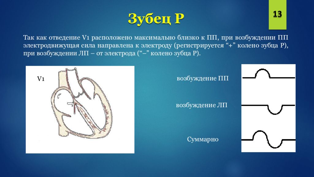 Экг презентация