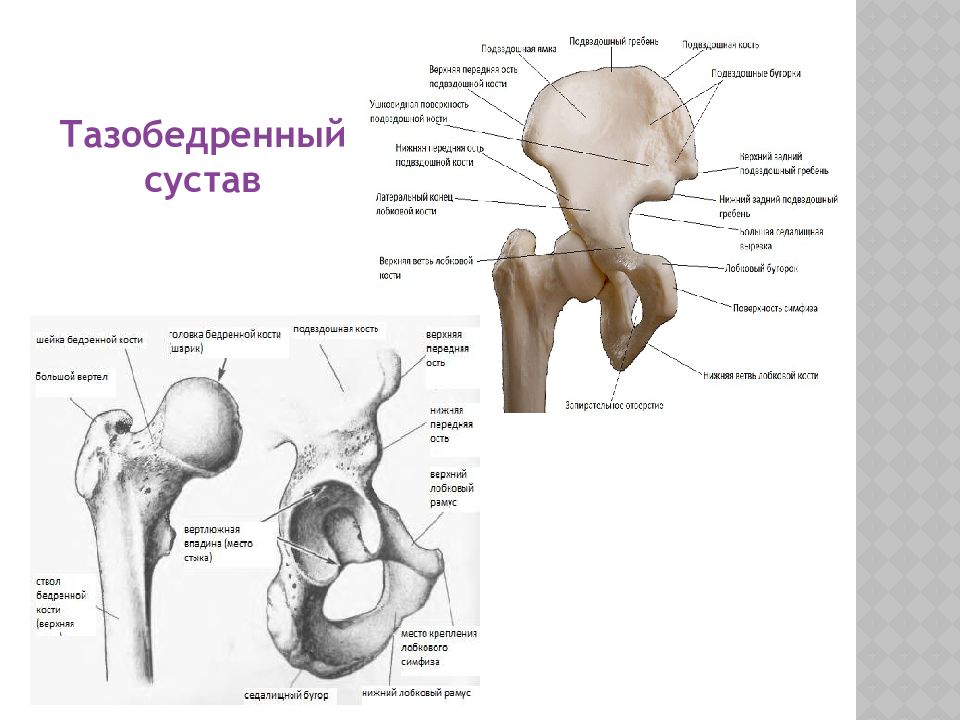 Большой вертел правой бедренной кости