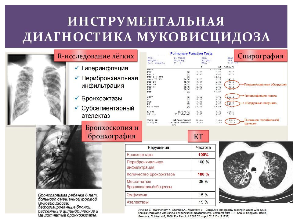 Кистозный фиброз презентация