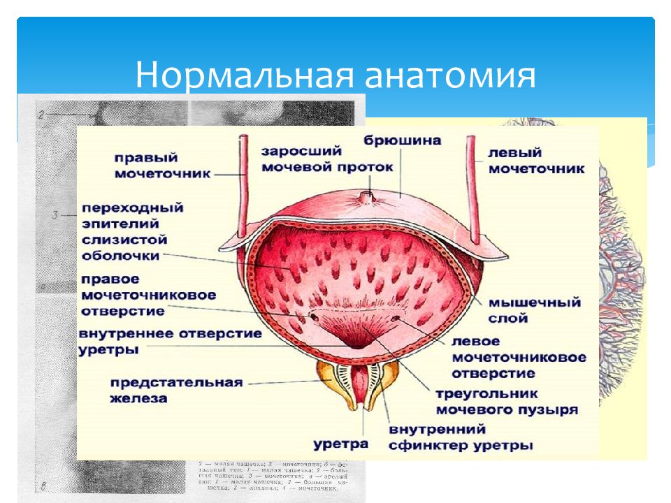 Анатомия мочевой пузырь картинка