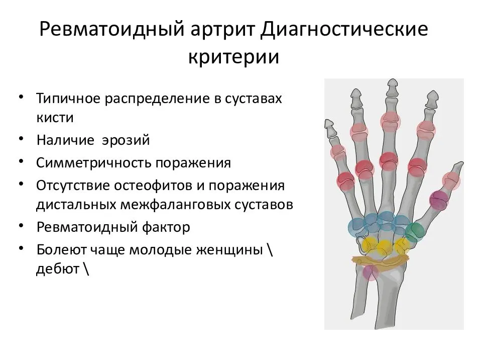 Амбулаторная карта ревматоидный артрит