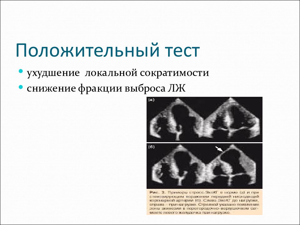 Диагноз в кардиологии