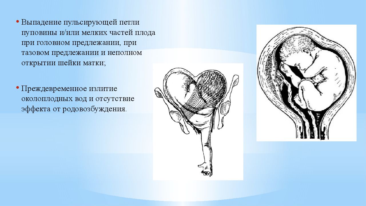 Сечение матки. Выпадение петель пуповины и мелких частей плода. Выпадение петли пуповины акушерская тактика. Предлежание петель пуповины. Предлежание мелких частей плода.