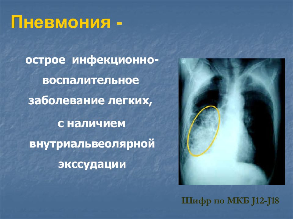 Пневмония у детей презентация