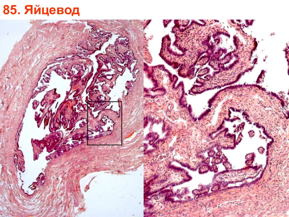 Яйцевод. Яйцевод гистология препарат. Маточная труба гистология. Яйцевод человека гистология. Строение яйцевода гистология.