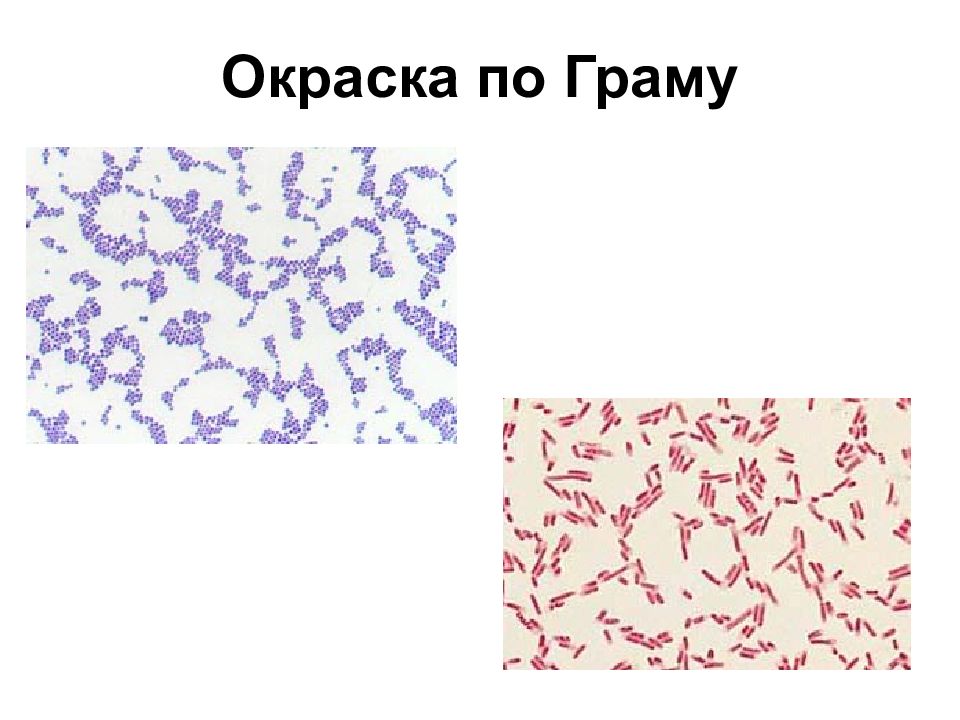 Окраска по граму. Окраска микроорганизмов по Граму. Окраска по Граму микробиология. Окраска бактерий по методу грама. Грамположительные бактерии окраска по Граму.