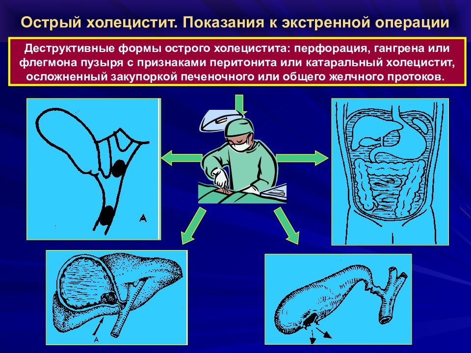 Механическая желтуха презентация по хирургии