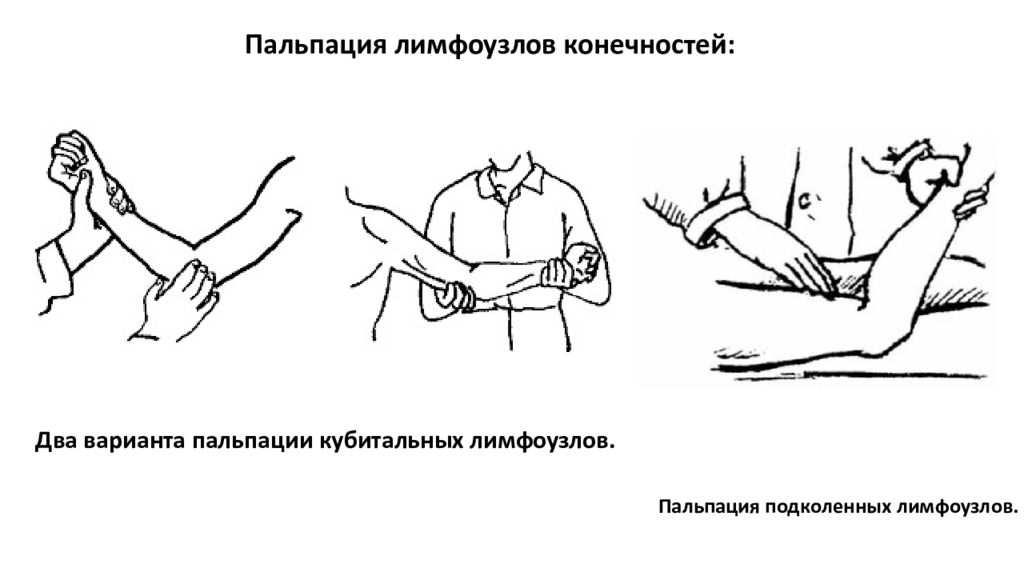 Пальпация лимфоузлов. Пальпация периферических лимфоузлов алгоритм. Пальпация лимфатических узлов алгоритм. Пальпация локтевых лимфатических узлов. Методика пальпации лимфоузлов.