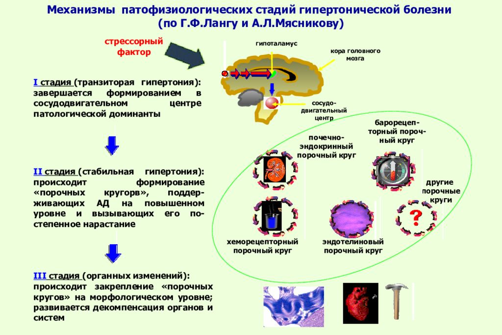 3 стадия гипертонической болезни