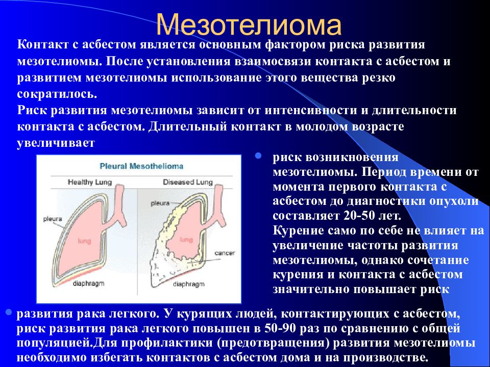 Мезотелиома плевры кт картина