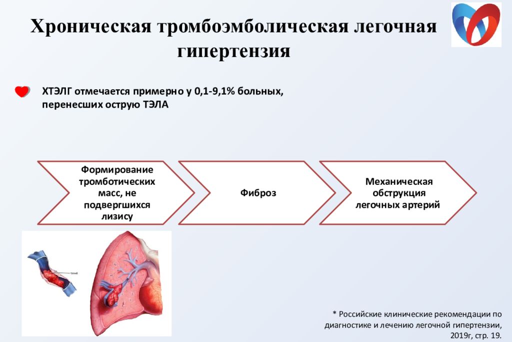 Легочная гипертензия картинки