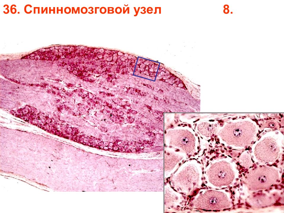 Спинномозговой узел рисунок