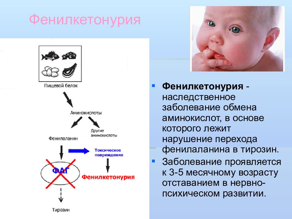 Болезнь фенилкетонурия презентация