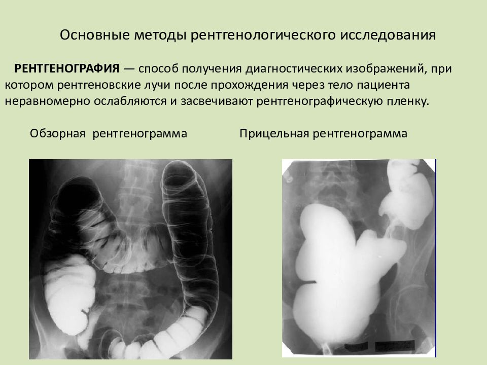 Рентгенологические методы исследования. Основные методики рентгенологического исследования. Рентгенография методы исследования. Рентгенография принцип метода. Специальные методы рентгенологического исследования.