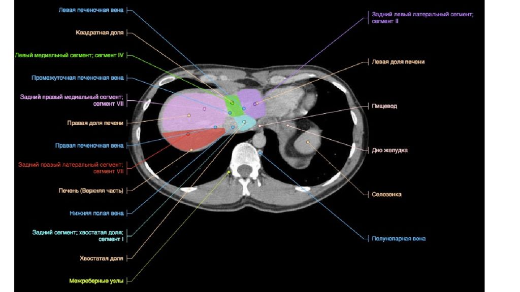 Кт сегмент. Сегменты печени кт анатомия. Доли печени на кт. Кт брюшной полости анатомические структуры. Лимфатические узлы брюшной полости кт анатомия.