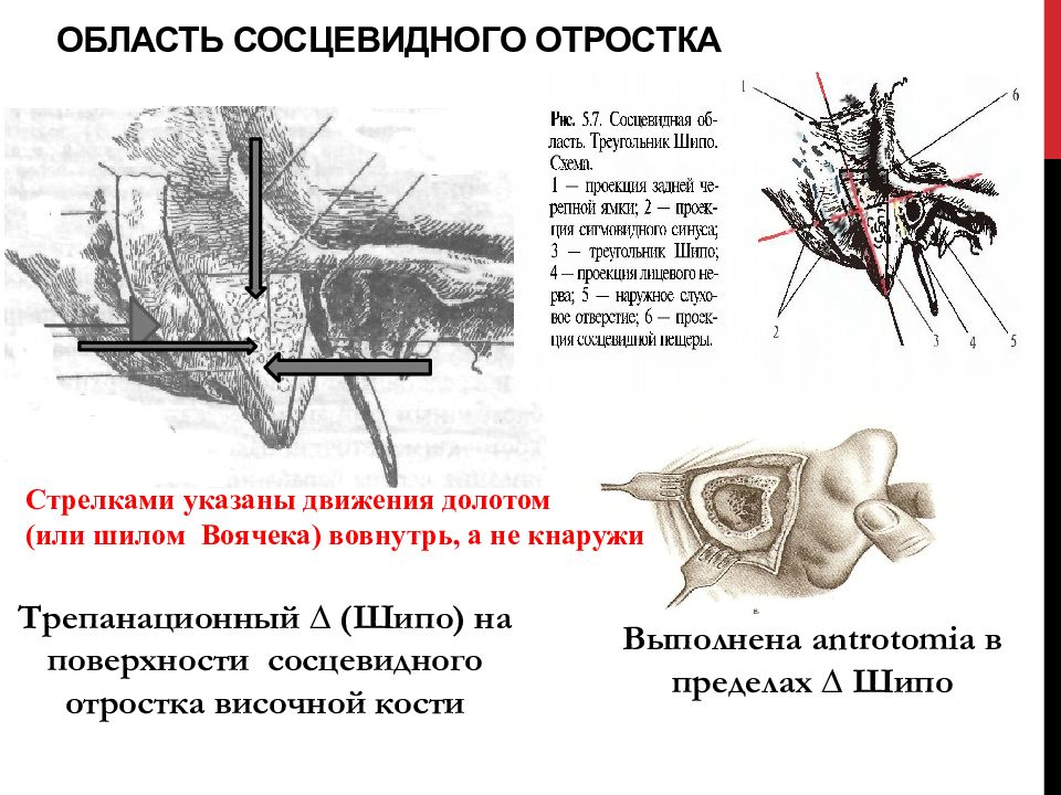 Сосцевидная кость. Область сосцевидного отростка топографическая анатомия. Строение сосцевидного отростка височной кости. Топографическая анатомия сосцевидной области треугольник шипо. Сосцевидный отросток анатомия строение.