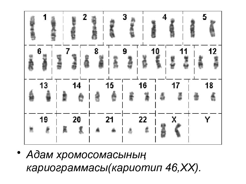 Кариотип 46 хх. Идиограмма кариотипа. Кариограмма хромосом. Идиограмма кариотипа человека. Нормальный мужской кариотип.