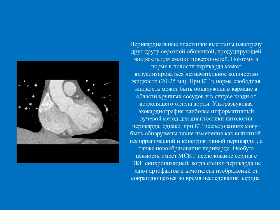 Жидкость в перикарде. Жидкость в полости перикарда на кт. Жидкость в перикарде сердца на кт. Жидкость в полости перикарда на кт норма. Перикард жидкость в перикарде норма.