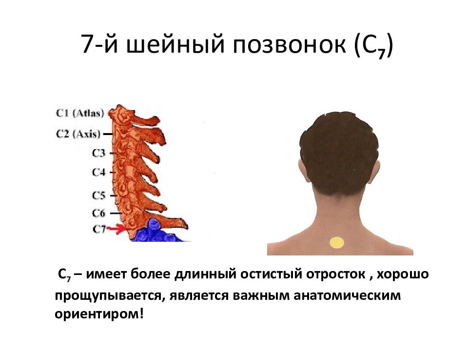 Остистые отростки позвоночника на схеме