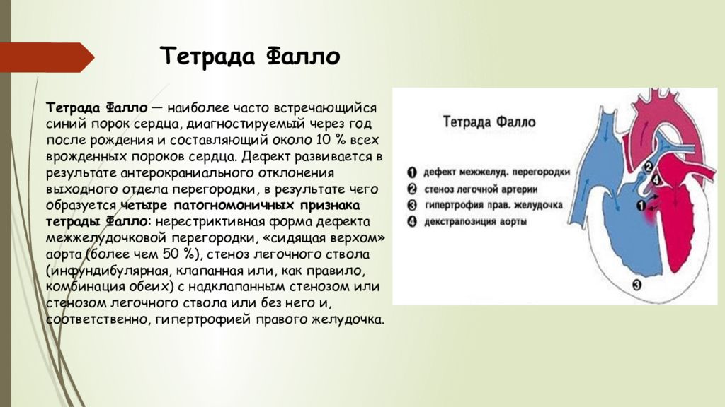 Врожденный порок сердца тетрада фалло презентация