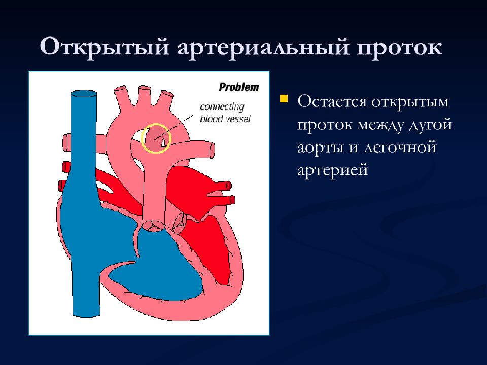 Пороки сердца картинки для презентации