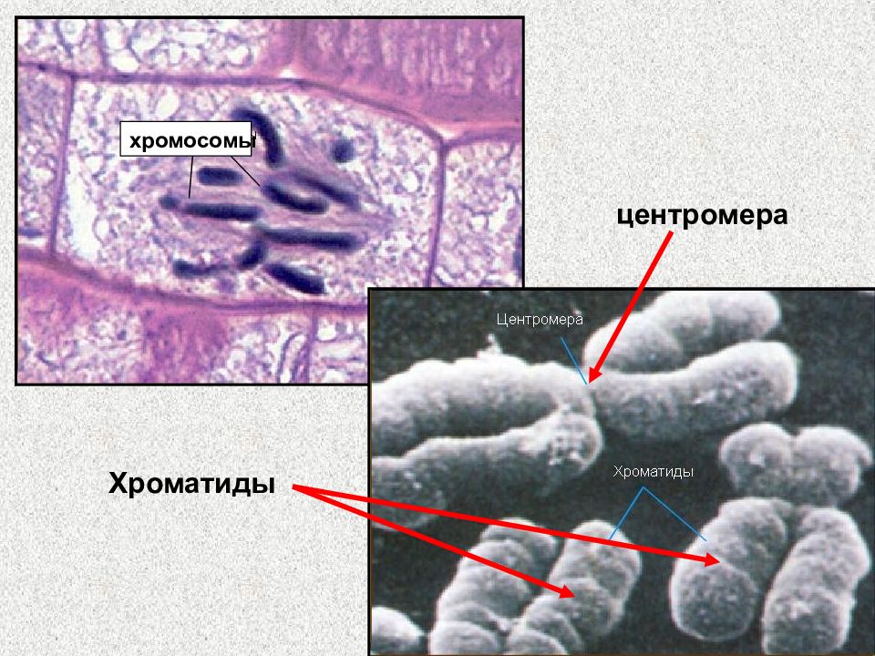 Хромосомы и хроматиды. Хромосома хроматида центромера. Центромеры клетки. Анафазное отставание хромосом. Отставание хромосом (хромосомные мостики в анафазе).