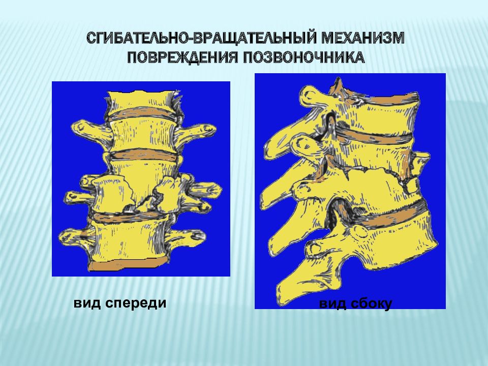 Заболевания и травмы позвоночника и таза презентация