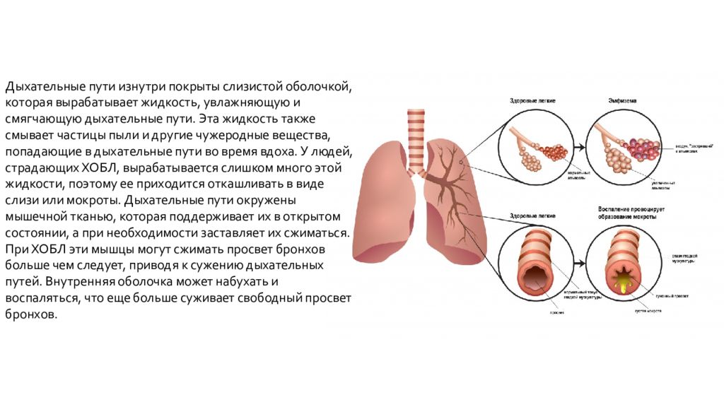 Профилактика хобл презентация