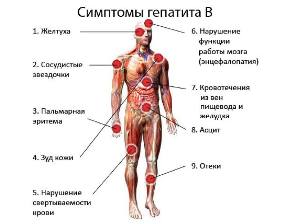 Признаки гепатита а у мужчин. Гепатит симптомы у мужчин. Гепатит д симптомы у мужчин.