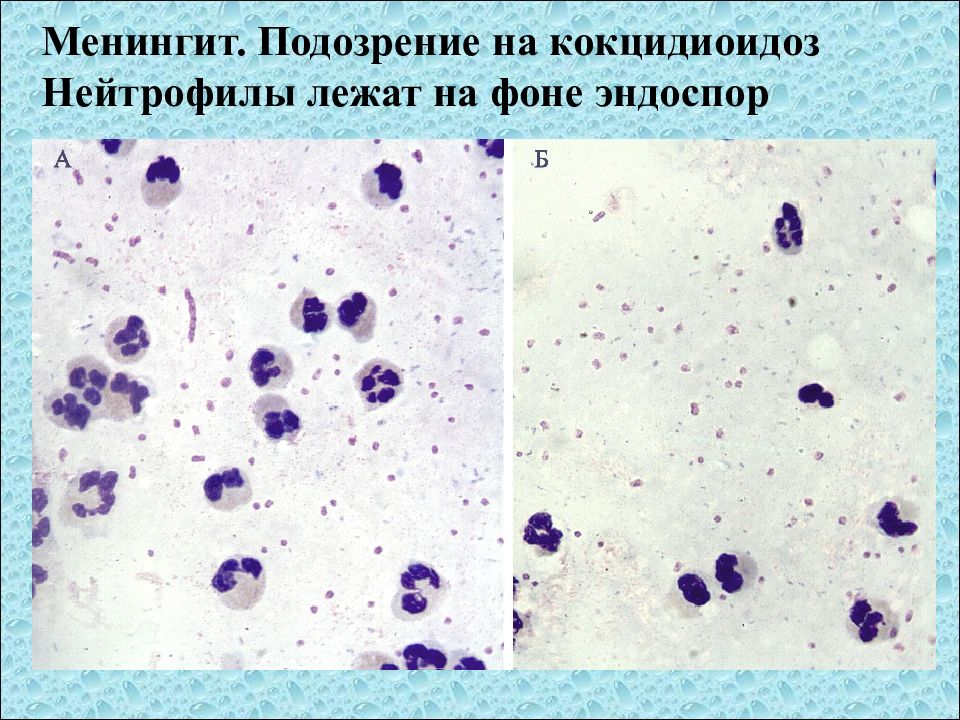 Исследование ликвора презентация