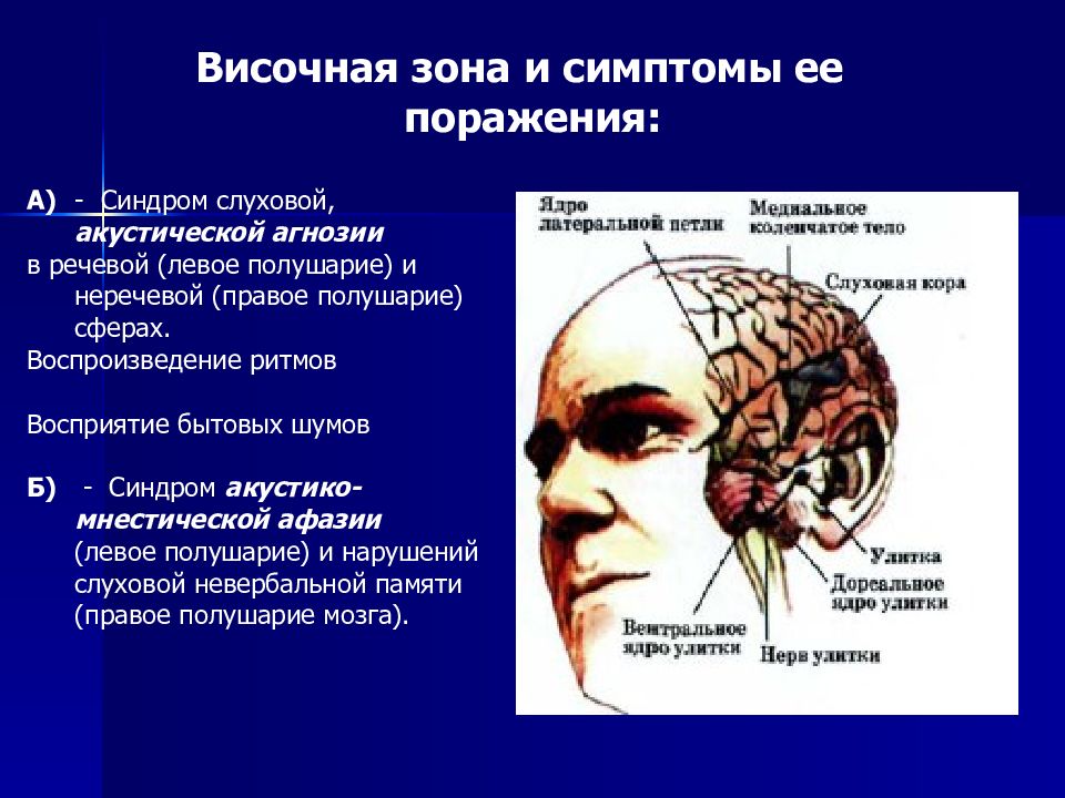 Височная функция мозга. Симптомы поражения коры височной доли головного мозга. Синдром поражения височной доли головного мозга. Поражение левой височной доли. Слуховая зона в височной доле.